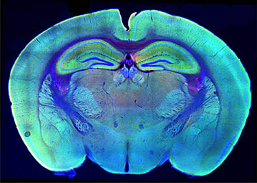 mode de vie shanna brain power activities